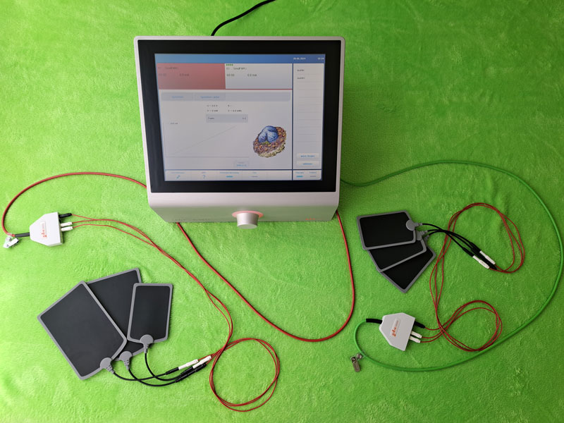 ergotherapeutische behandlungsmethoden